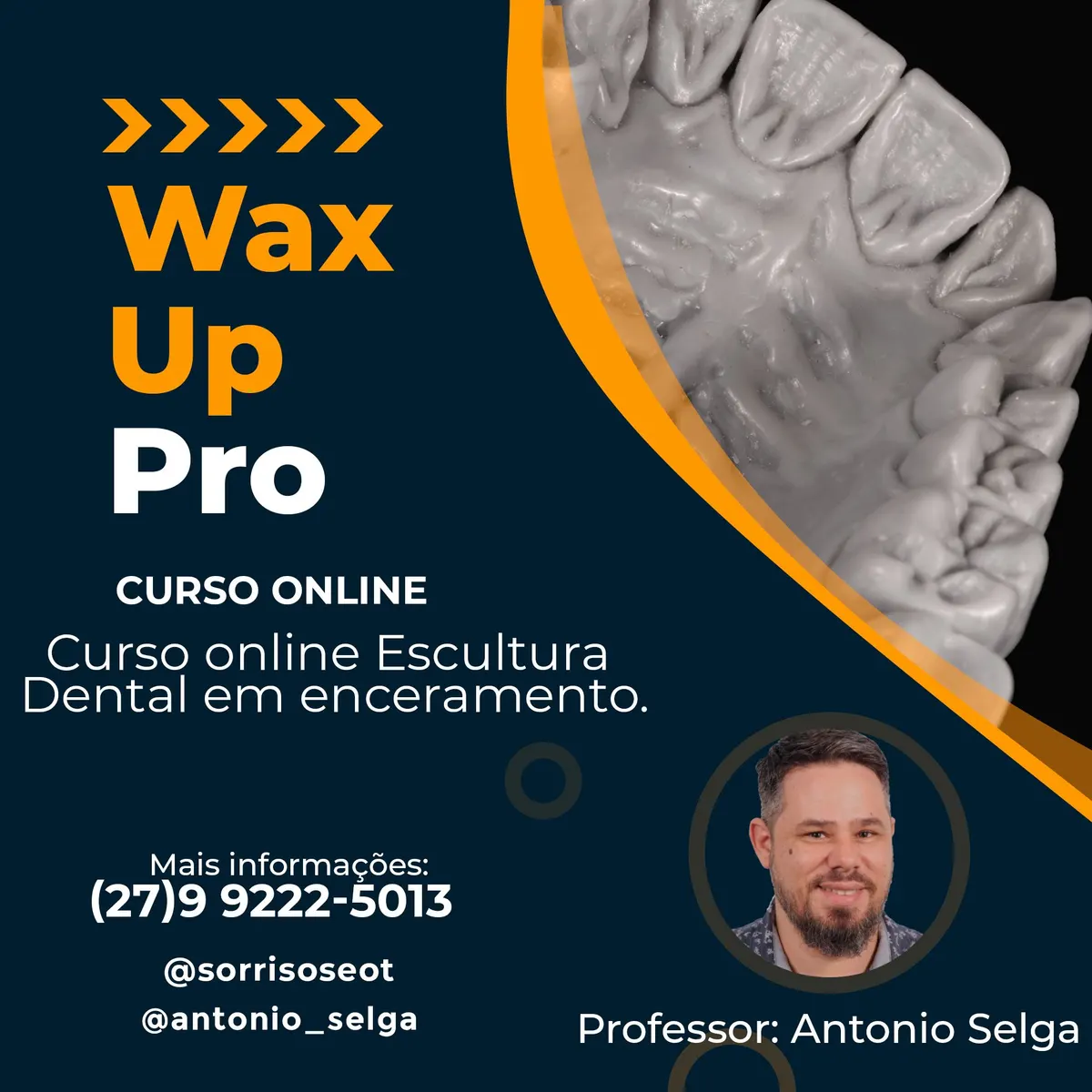 Curso Online Escultura Dental em Enceramento