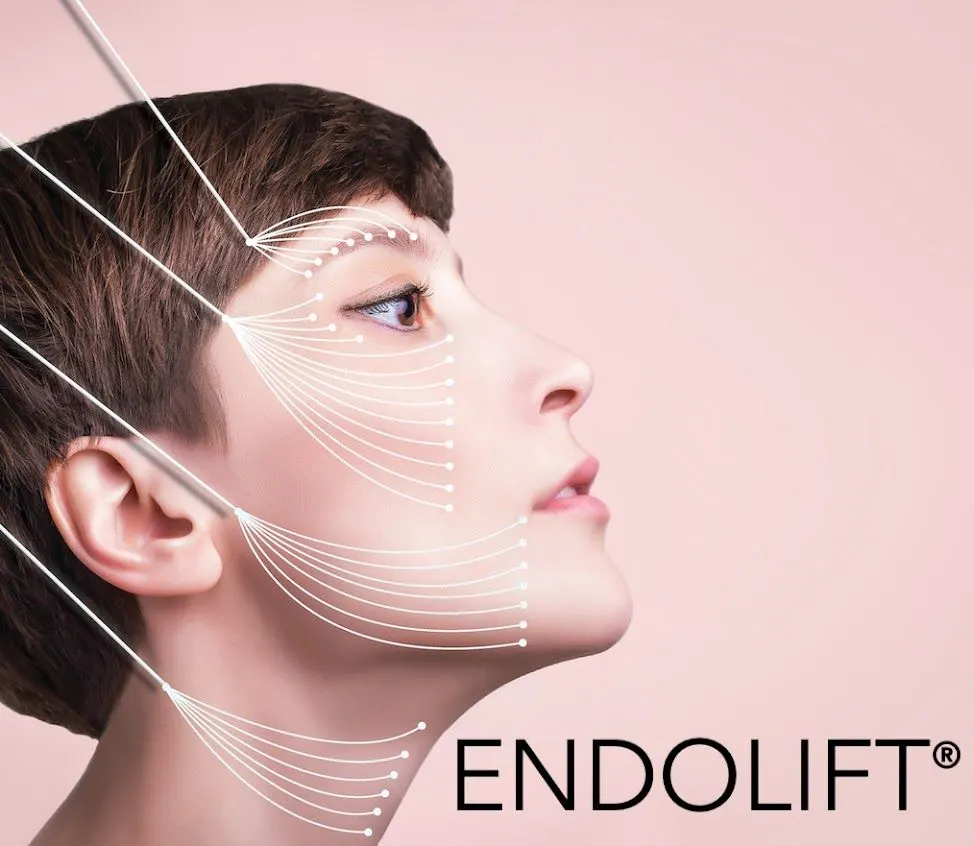 Material Curso: Endolaser / Endolift Teorico