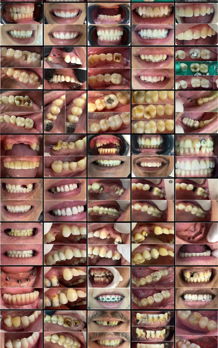 FOTOS DE ANTES x DEPOIS DENTISTA