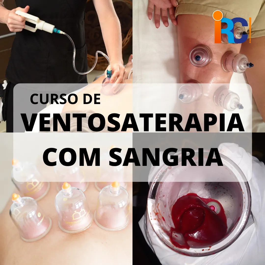 Curso de Ventosaterapia com Sangria