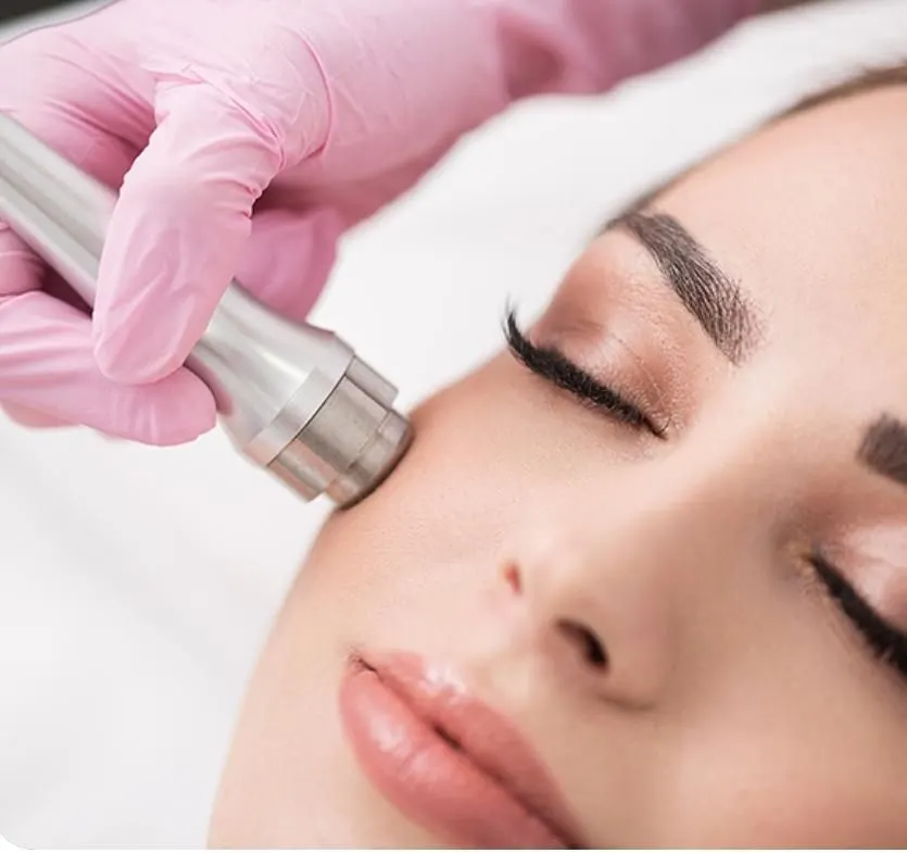 Peeling de Diamante ou Dermoabrasão