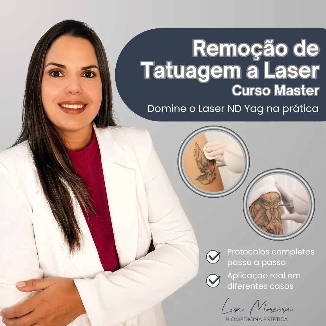 Remoção de Tatuagem e Micropigmentação a Laser – Master em Laser ND Yag