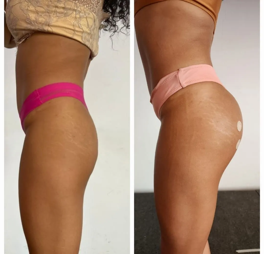 Curso Glúteo Max