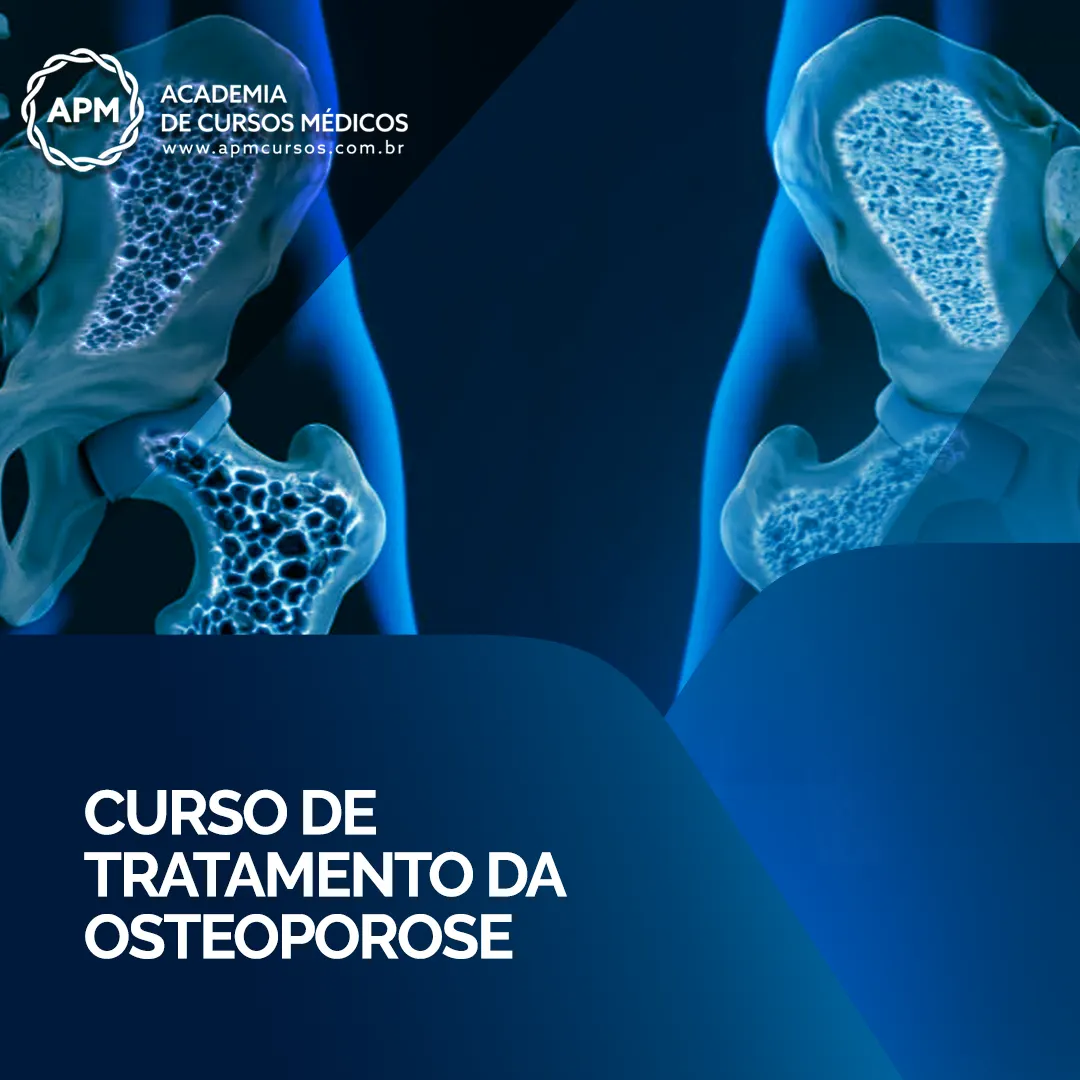 CURSO DE TRATAMENTO DA OSTEOPOROSE