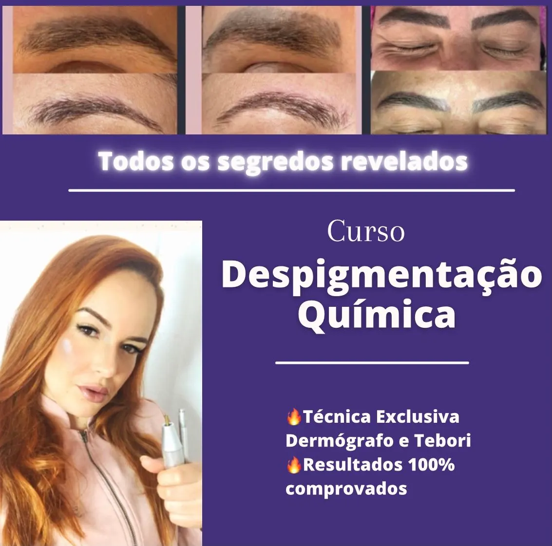 Curso de Despigmentação Química