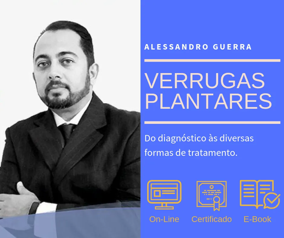 Verruga Plantar, do Diagnóstico às Várias Formas de Tratamentos.