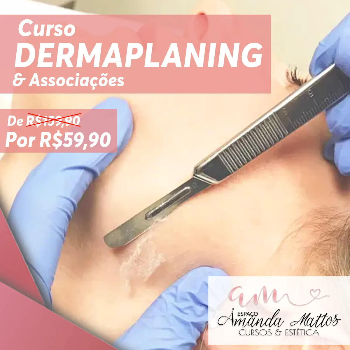 Curso de DERMAPLANING & Associações