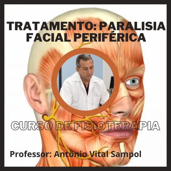 Tratamento: Paralisia Facial Periférica - Curso de Fisioterapia