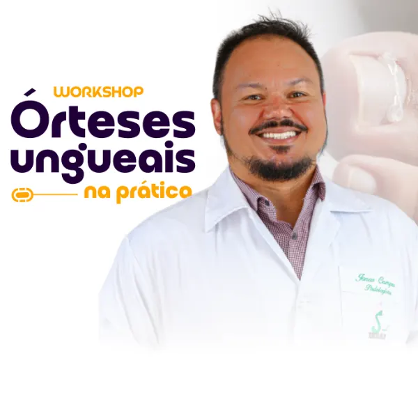 Workshop Órteses Ungueais na Prática