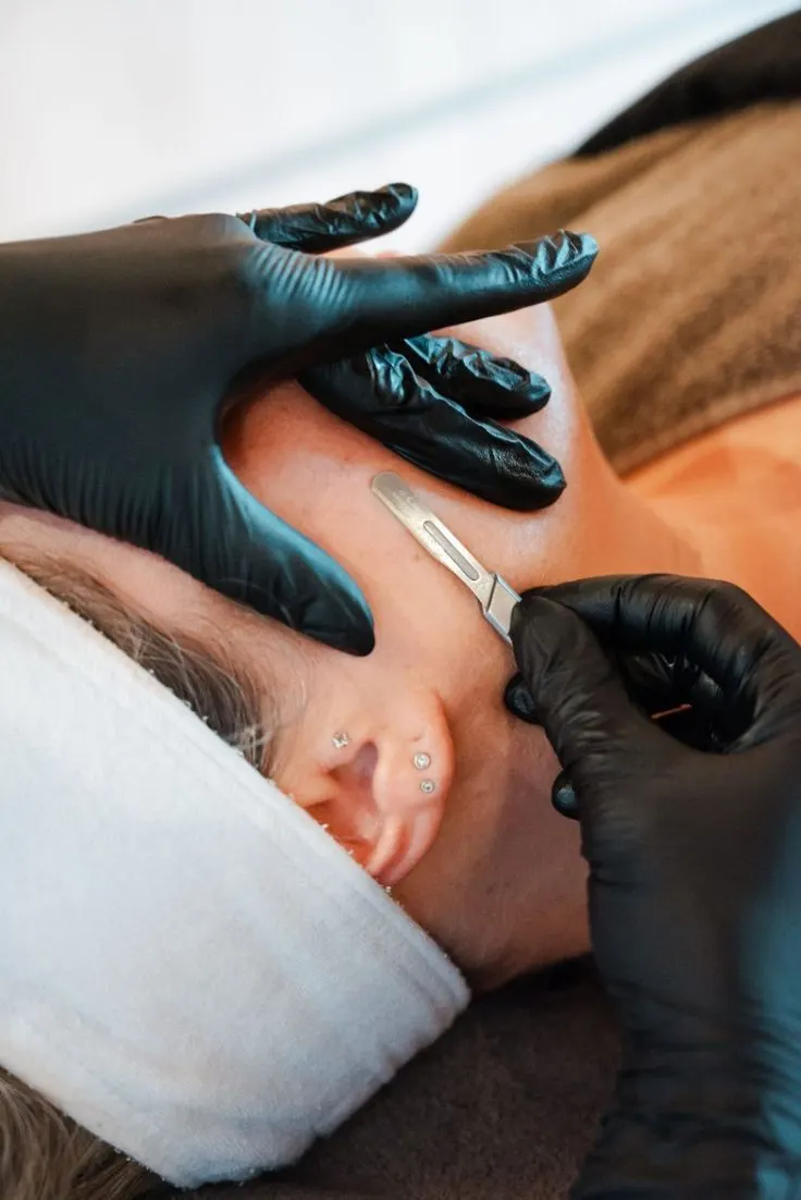 Dermaplaning da Teoria a Prática