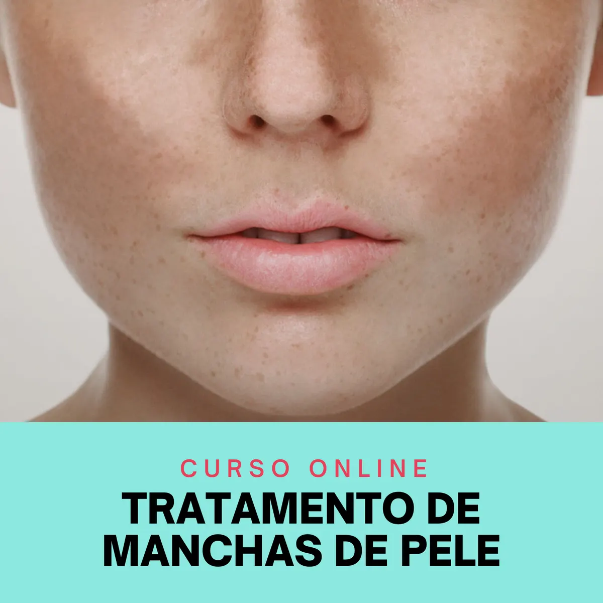 Curso de Tratamento de Manchas de Pele