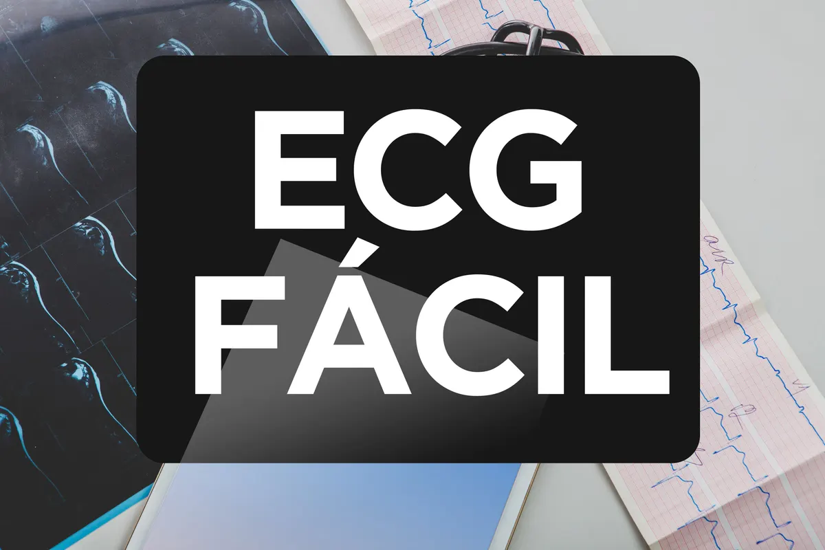 ECG Fácil