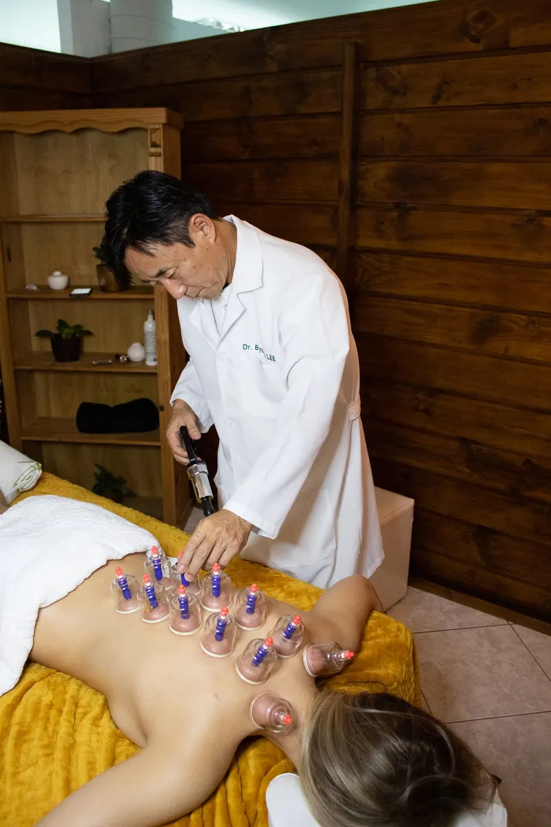 Ventosaterapia por Dr. Byung Il Lee