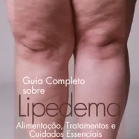 Guia Completo Sobre Lipedema - Alimentação, Tratamentos e Cuidados Essenciais