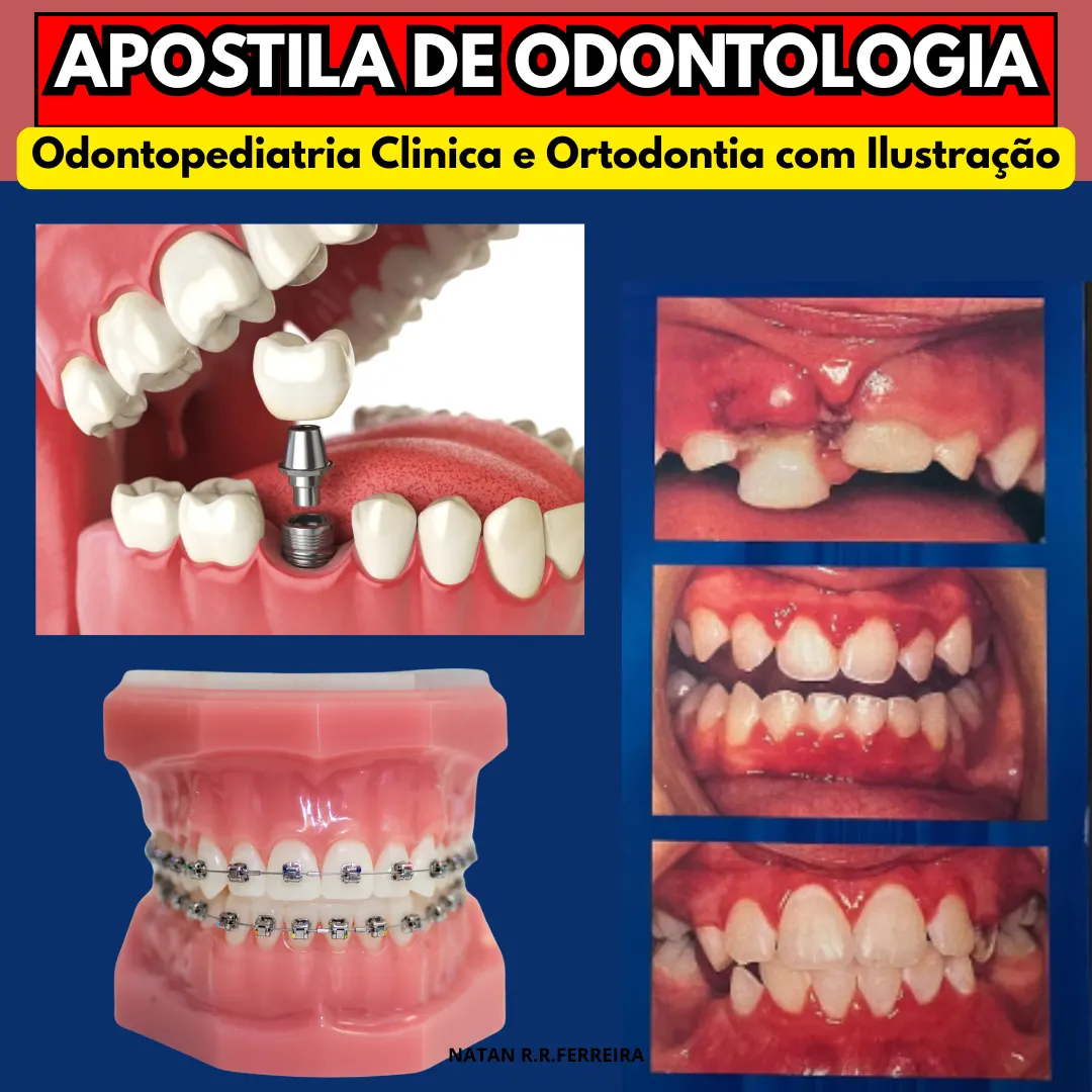 Apostila de Odontologia: Odontopediatria Clinica e Ortodontia com Ilustração