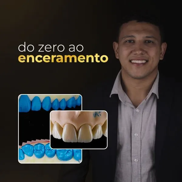 Curso do Zero ao Enceramento