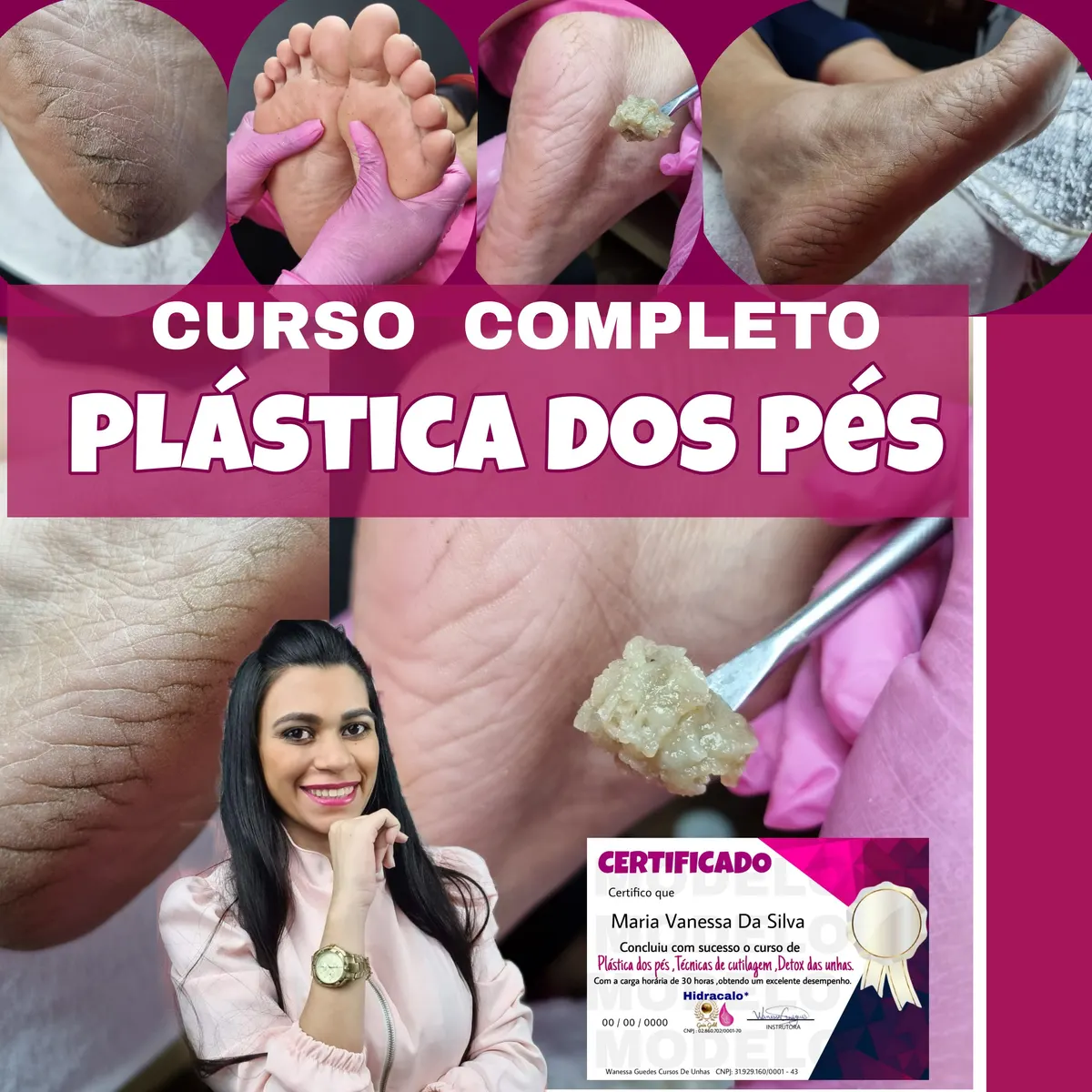 Plástica dos pés,remoção de rachaduras dos pés