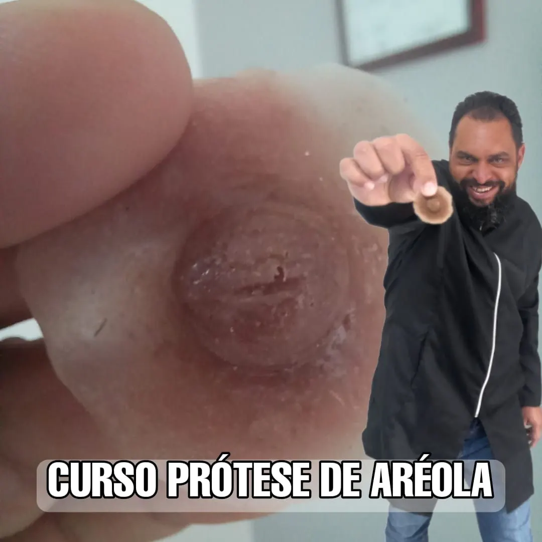 Curso Prótese de Aréola em Silicone