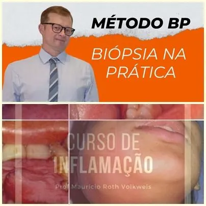 Especial para Dentistas - Domine Biópsias e Inflamação
