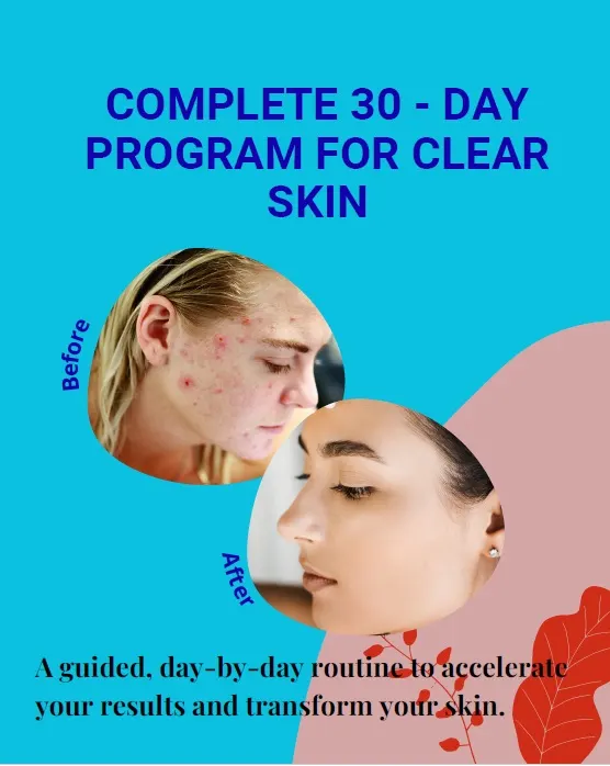 Complete 30 day program for clear skin